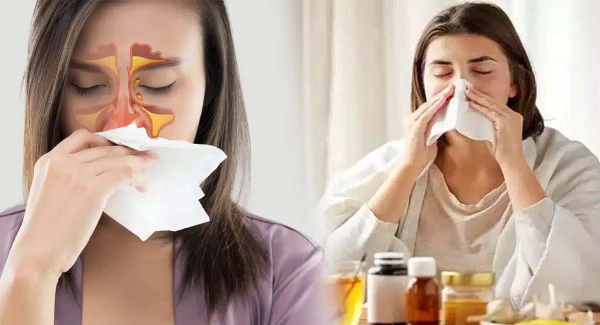 Health Tips on Nasal congestion, stuffy nose