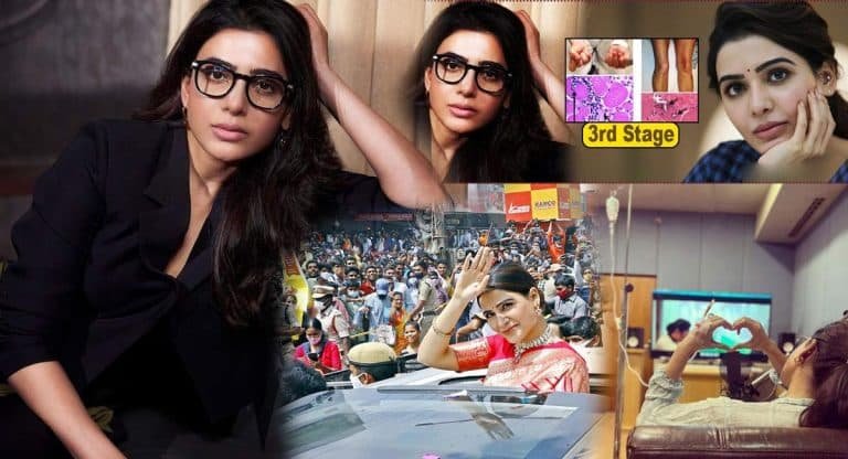 Samantha : స‌మంత వ్యాధి థ‌ర్డ్ స్టేజ్‌లో ఉందా.. టెన్ష‌న్ ప‌డుతున్న అభిమానులు