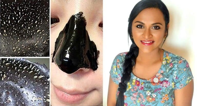 Beauty Tips : అమేజింగ్ రెమెడీ, వైట్ హెడ్స్, అలాగే బ్లాక్ హెడ్స్ ఐదు నిమిషాలలో నొప్పి లేకుండా తీసివేయొచ్చు…!