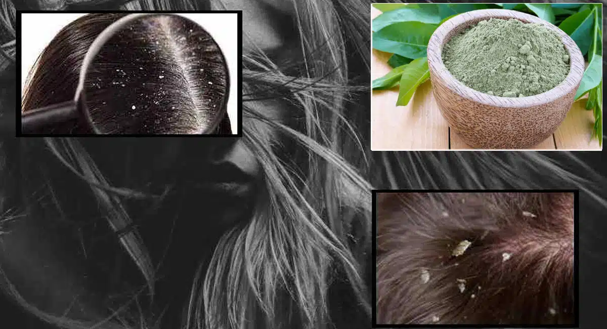Hair Tips on Bhringraj Powder And Coconut Oil