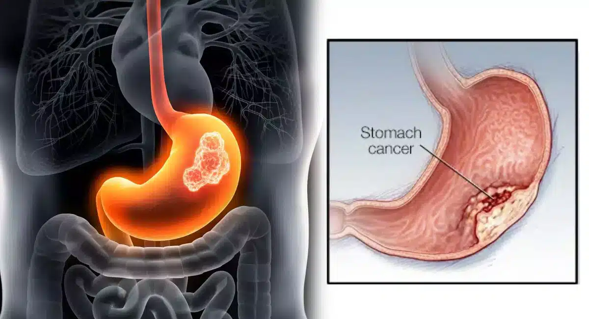 If these symptoms appear on the face, it is like having stomach cancer