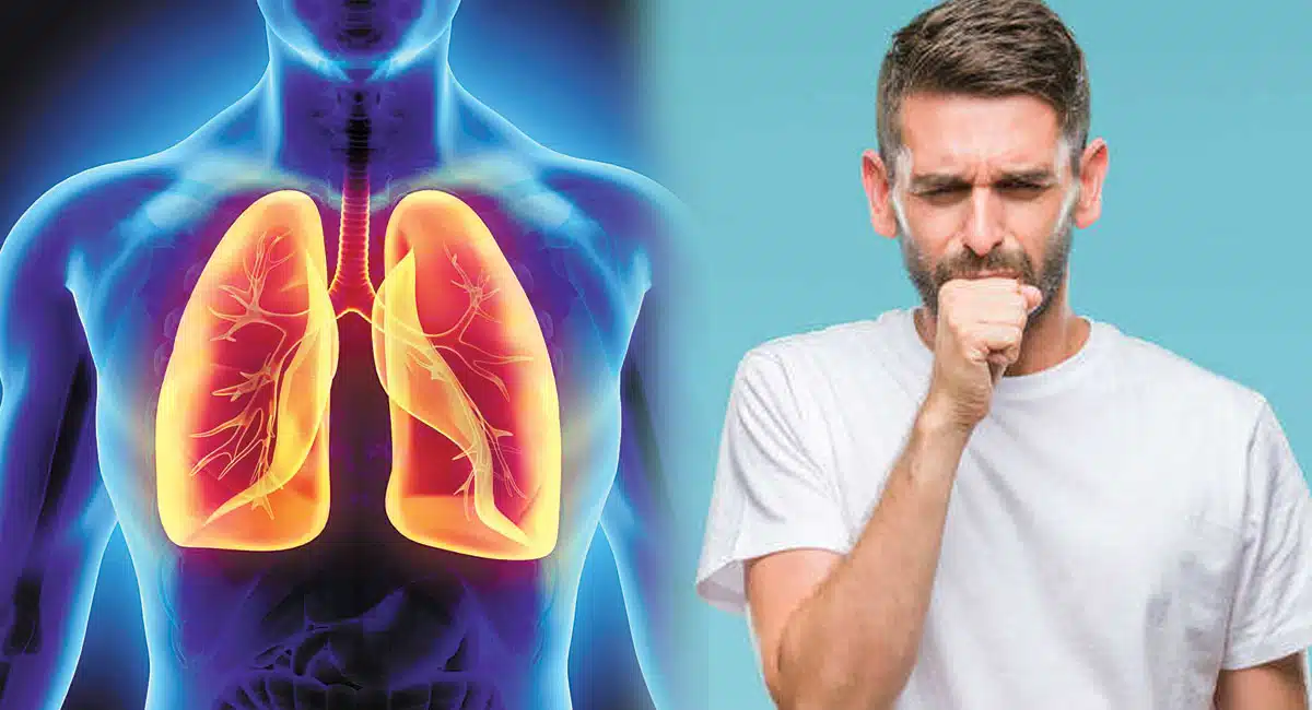 Health Problems If you suffer from constant cough, your lungs are in danger