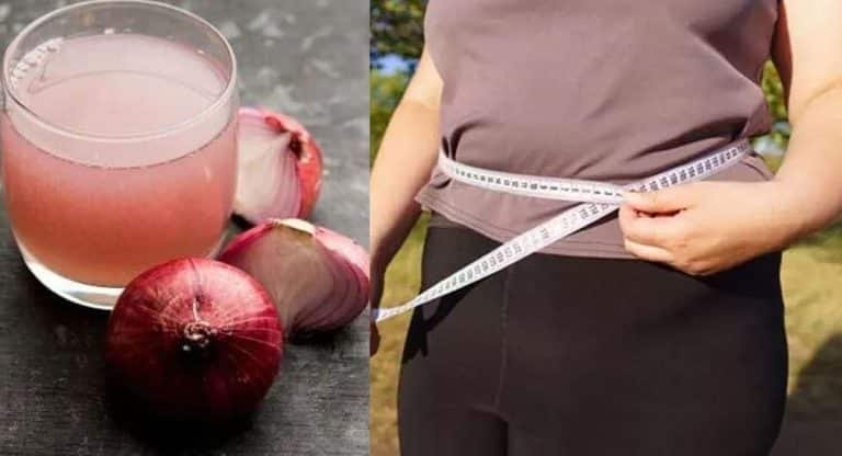 Health Tips : ఉల్లిపాయతో ఊబకాయం సమస్యకు ఇట్టే చెక్ పెట్టవచ్చు..!!