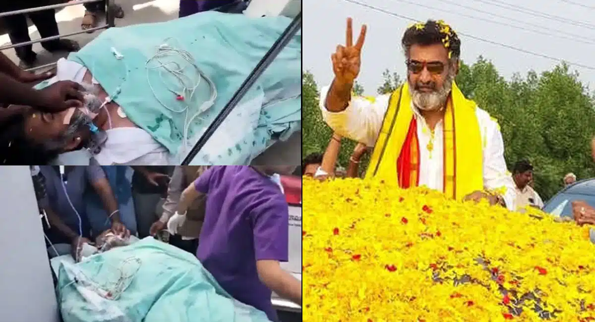 Breaking nandamuri Taraka Ratna among the living and dead