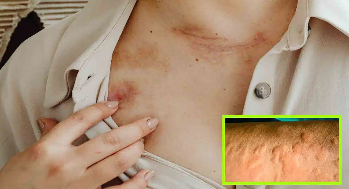 These substances can cause itching and rashes