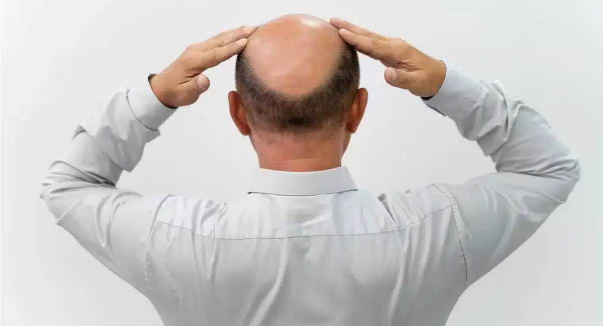 Hair Tips Fallen hair will re-grow within a week
