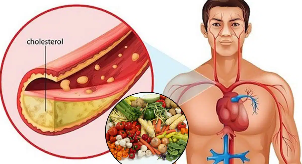 This is the best cooking oil without cholesterol
