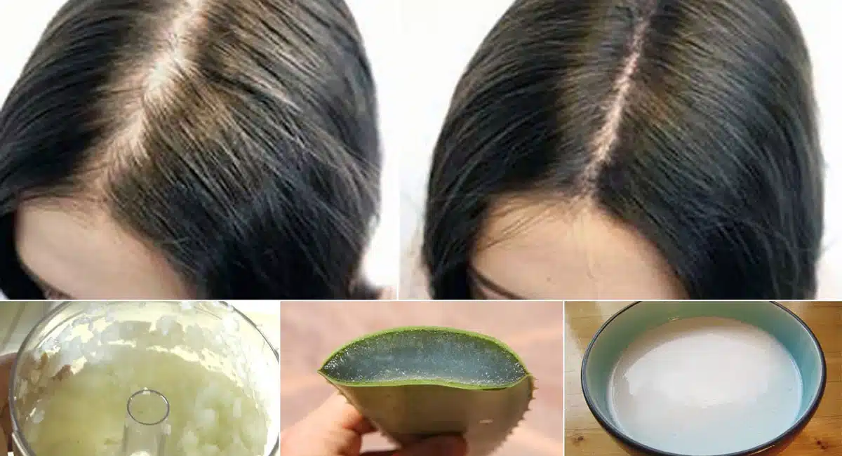 your hair will grow tremendously in 7 days by spending 1 rupee