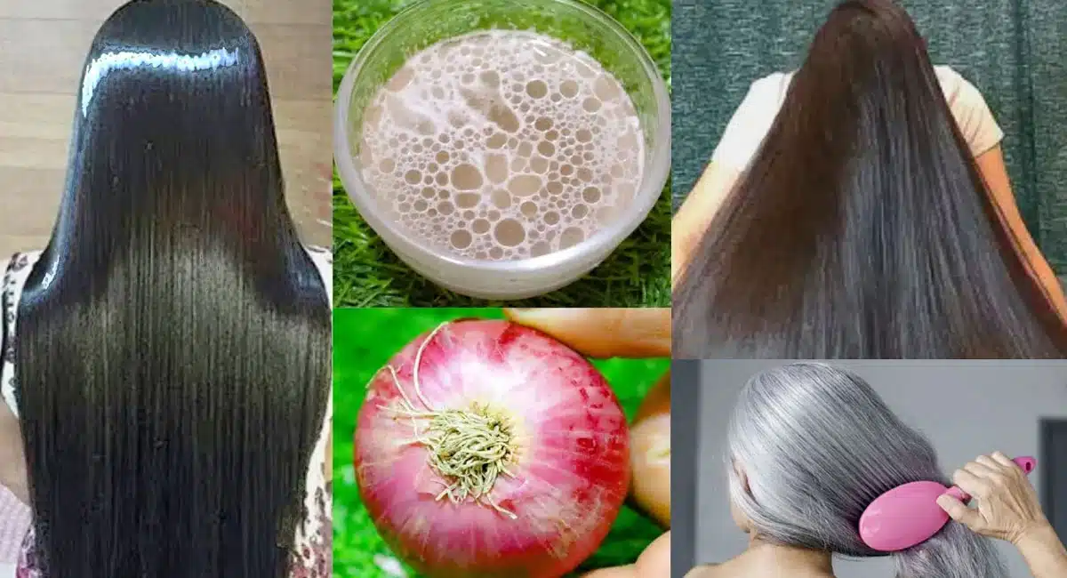 Hair Tips Are you suffering from white hair in your 20s