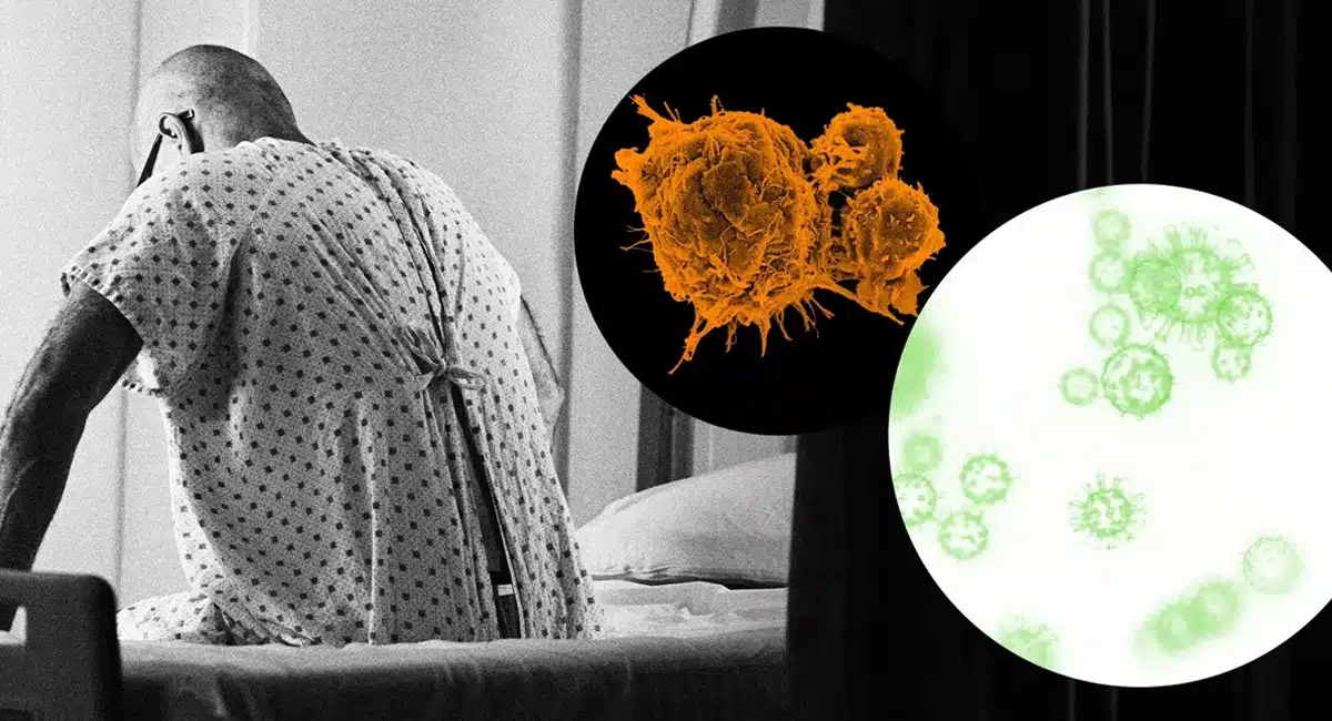 If these symptoms are seen then it can be cancer