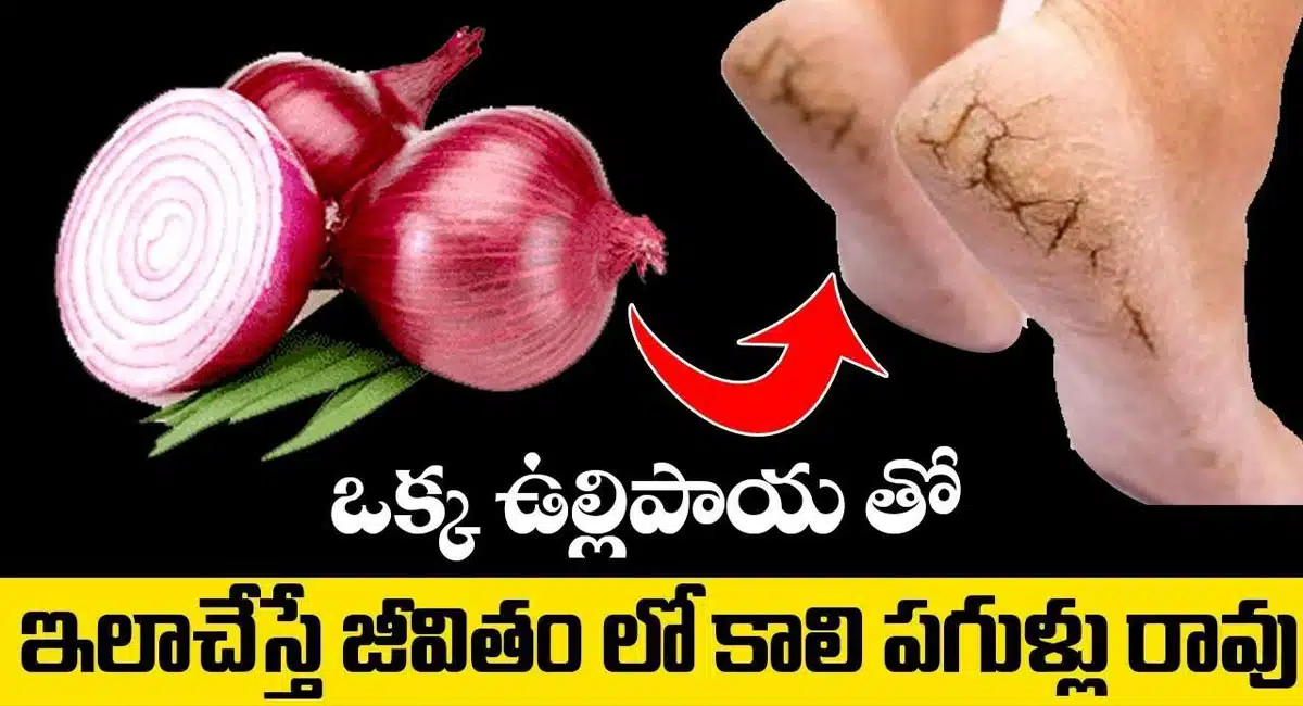 Eliminate Cracked Heels and get White and Smooth Feet