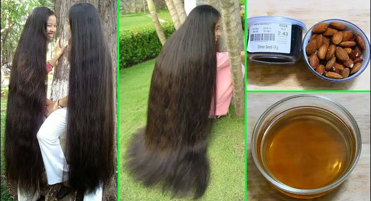 Hair loss problem can be checked with this oil