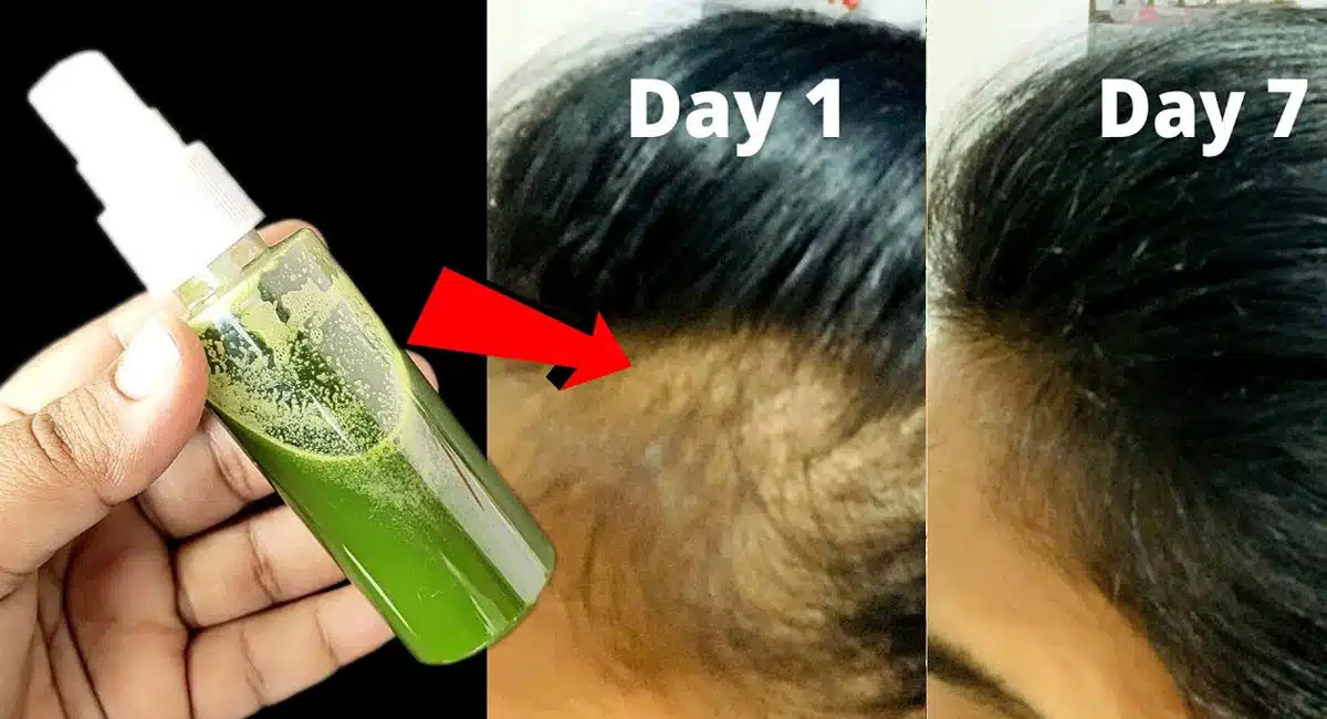 If you do this with curry leaves, hair will not fall during birth