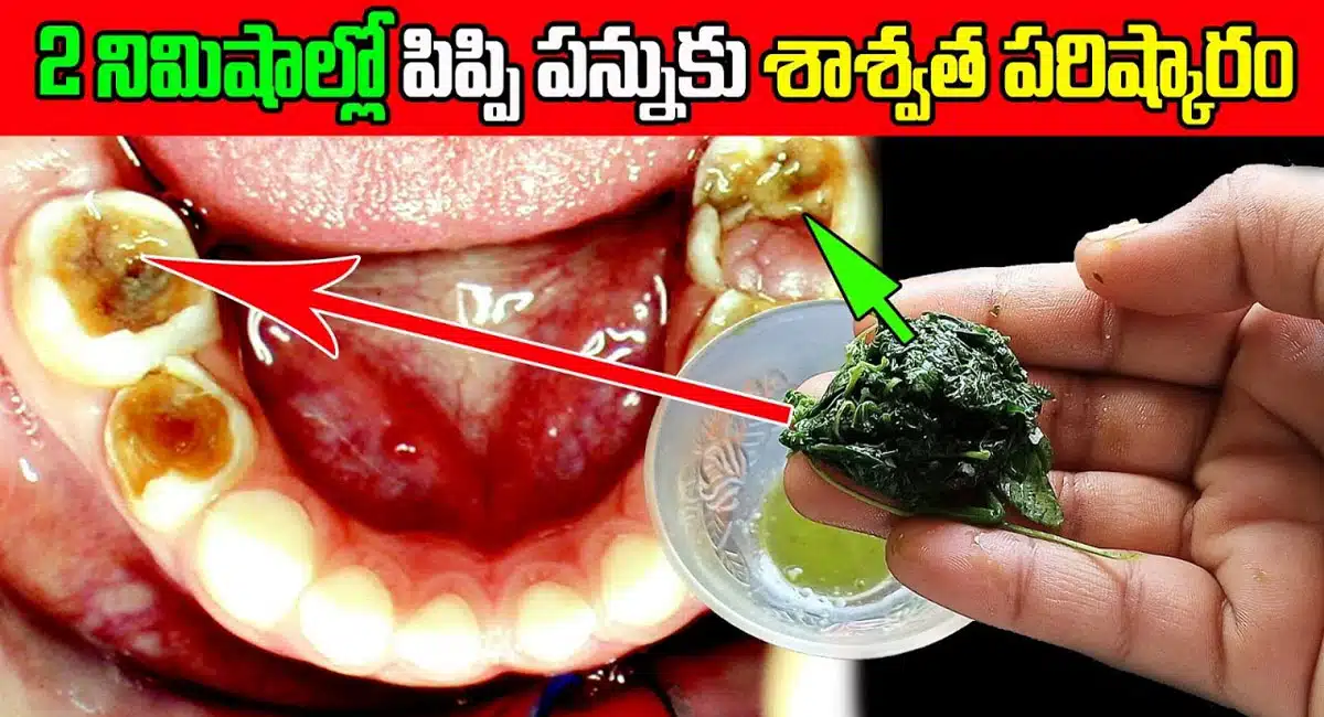 How to Whiten teeth at home