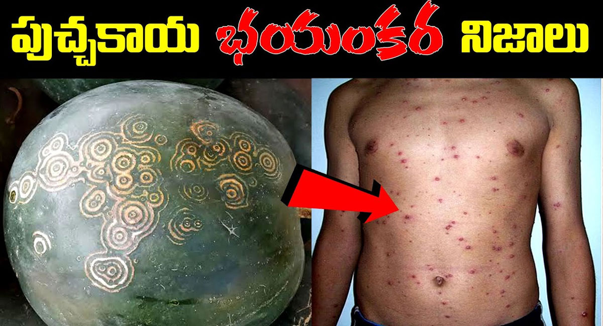 Watermelon : పుచ్చకాయ తినే ప్రతి ఒక్కరు తప్పక తెలుసుకోవాల్సిన విషయాలు..!!