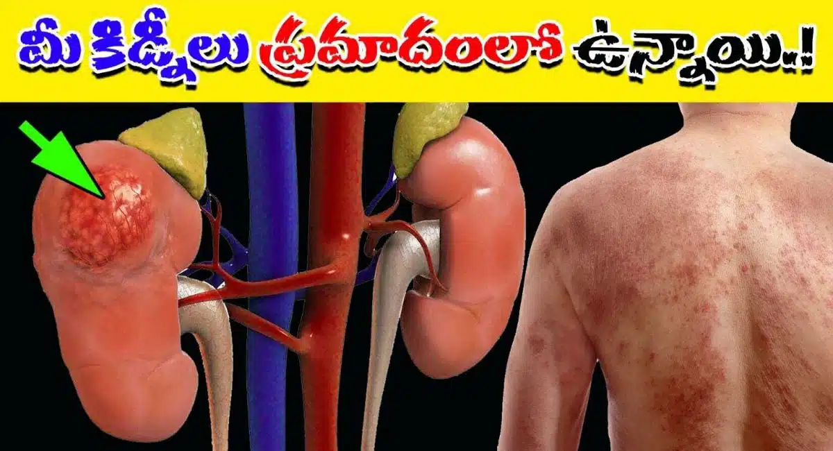 If these symptoms appear in the body it is like the kidneys are in danger