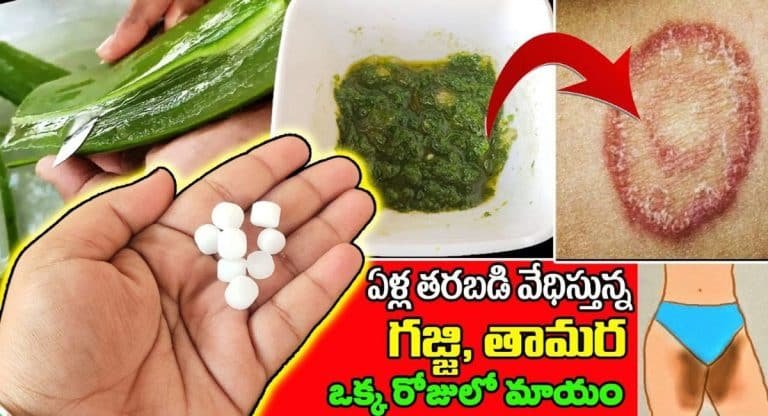 Health Benefits : భయంకరమైన గజ్జి ,తామర రాత్రికి రాత్రే మాయం…!