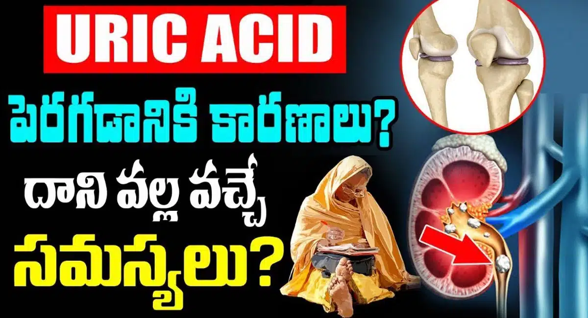 This is the real reason for the increase in Uric Acid Tips