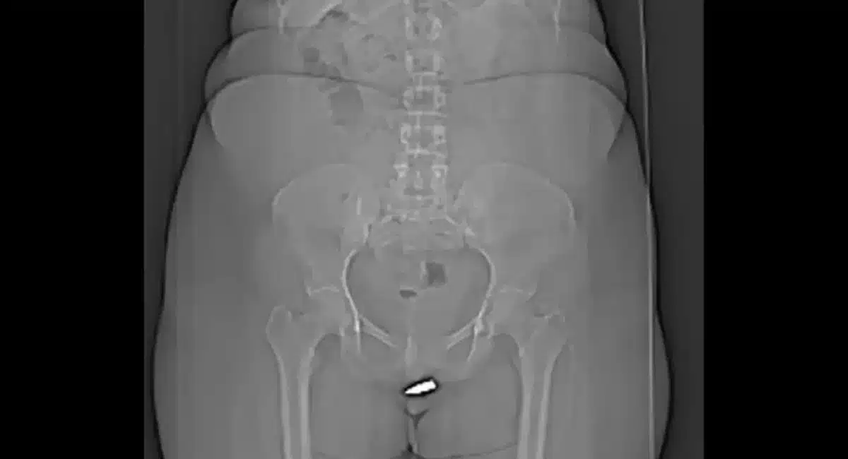 Viral News A young woman went to the hospital with pain in her private part