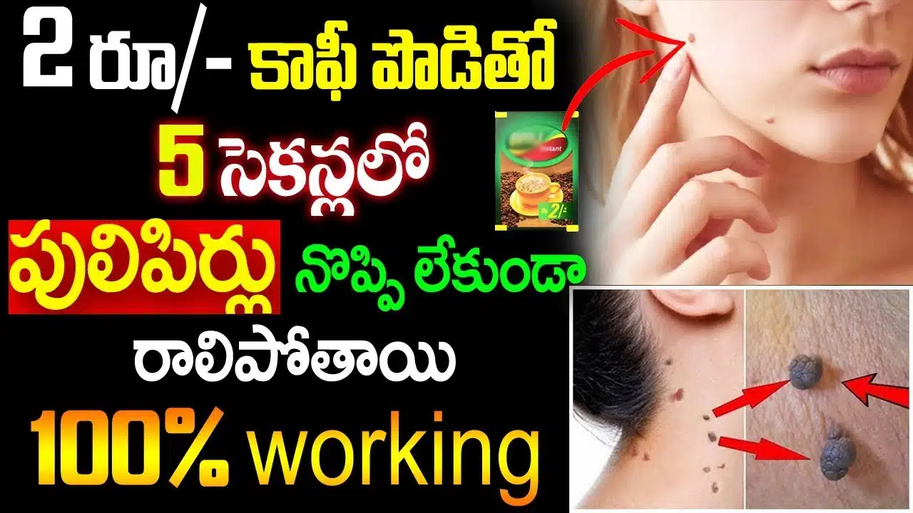 With coffee powder, pimples fall off painlessly in 5 seconds
