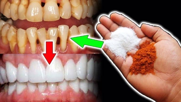 Whiten Teeth : రెండు నిమిషాలలో ఎంతటి గార పట్టిన పసుపు పళ్ళైన తెల్లగా మెరిసిపోతాయి..!!