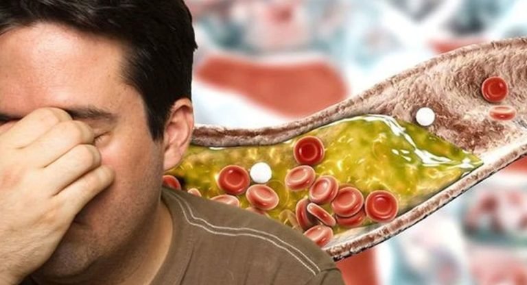 Cholesterol : ఈ కొలెస్ట్రాల్ తో ఎన్నో ప్రమాదకర వ్యాధులు… ఇలా ట్రై చేస్తే.. మంచులా కరుగుతుంది…!
