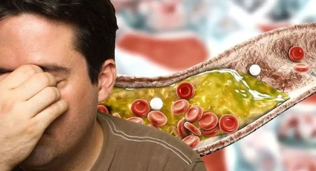 Many dangerous diseases with this cholesterol will melt like ice if you try this