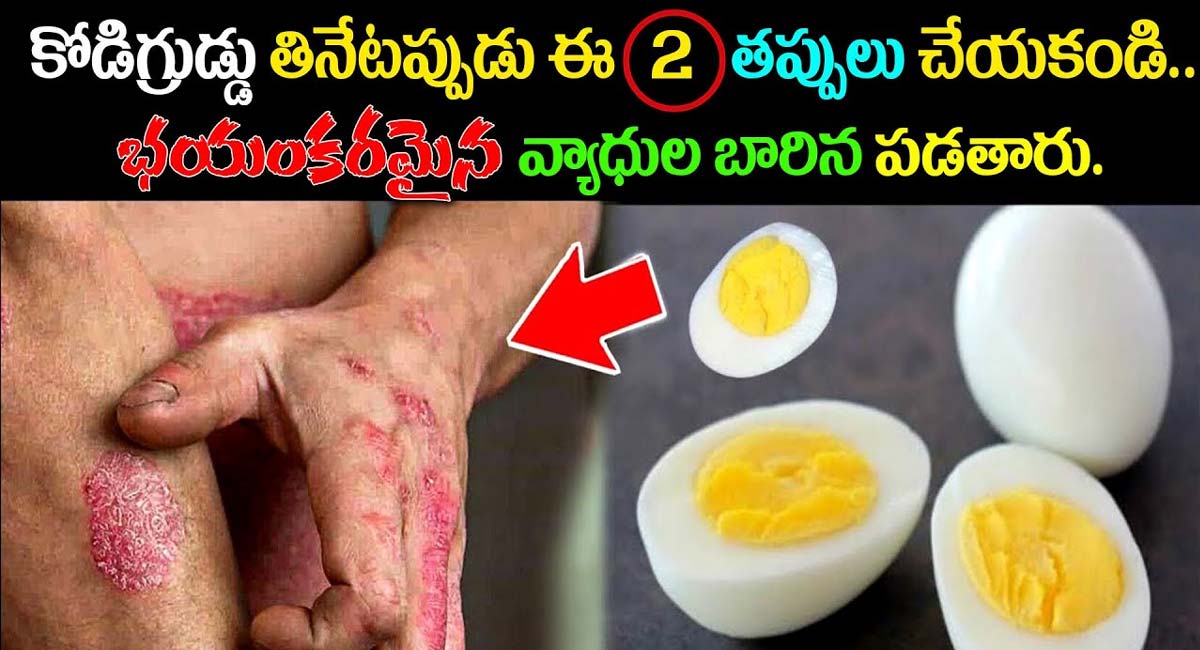 Eggs : కోడుగుడ్డు తినేటప్పుడు ఈ 2 తప్పులు చేయకండి… భయంకరమైన వ్యాధుల బారిన పడతారు…!