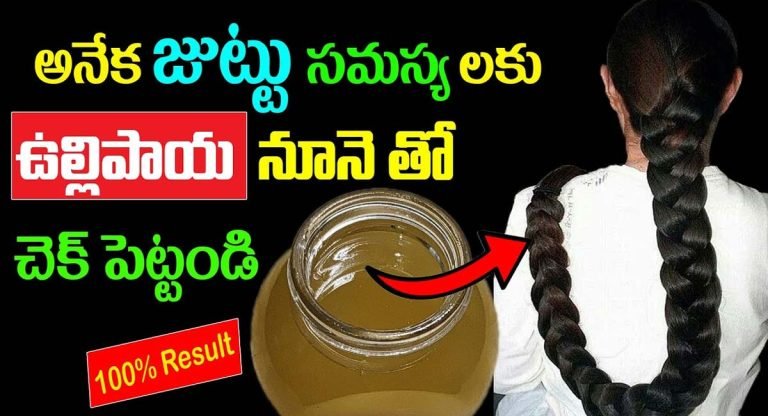 Hair Tips : అనేక జుట్టు సమస్యలకు ఉల్లిపాయ నూనెతో చెక్ పెట్టండి…!