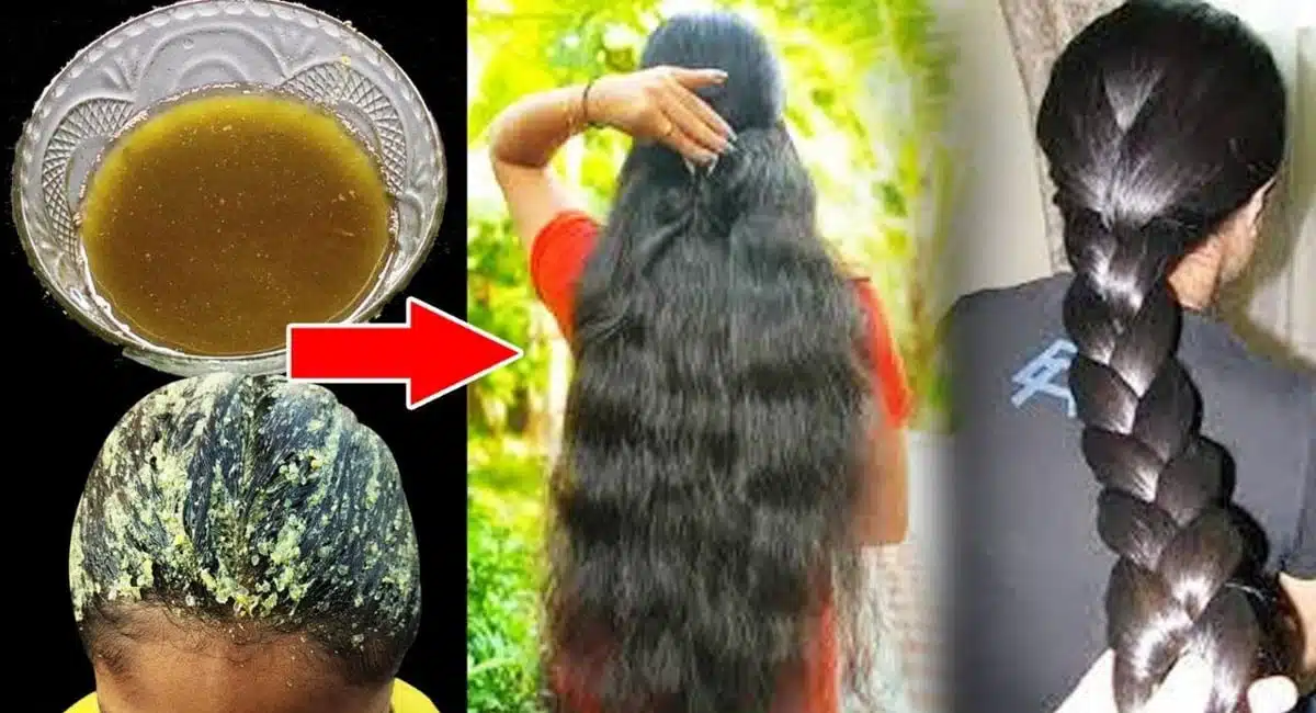 hair that falls out in clumps grows inches in weeks