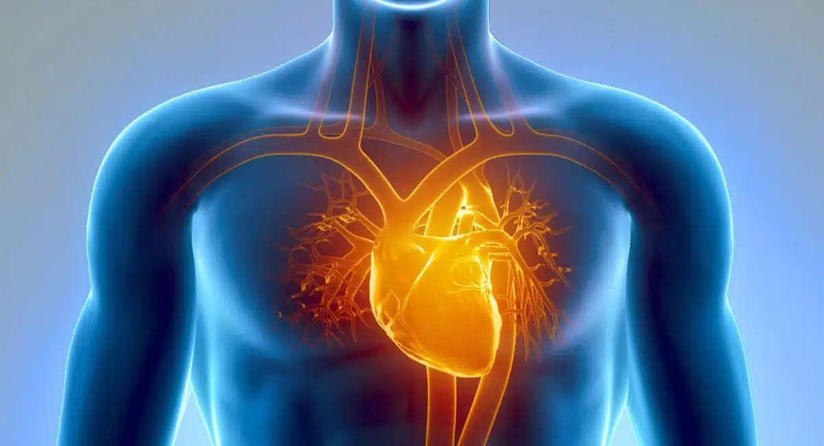 Rare Heart Diseases