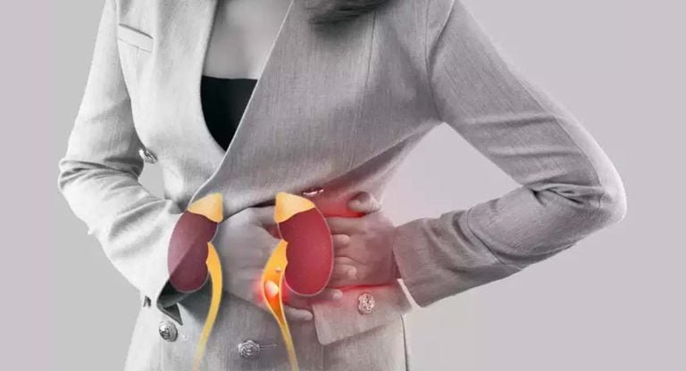 Kidney Stones : కిడ్నీలో రాళ్లు పోవాలంటే వీటిని తినండి…!