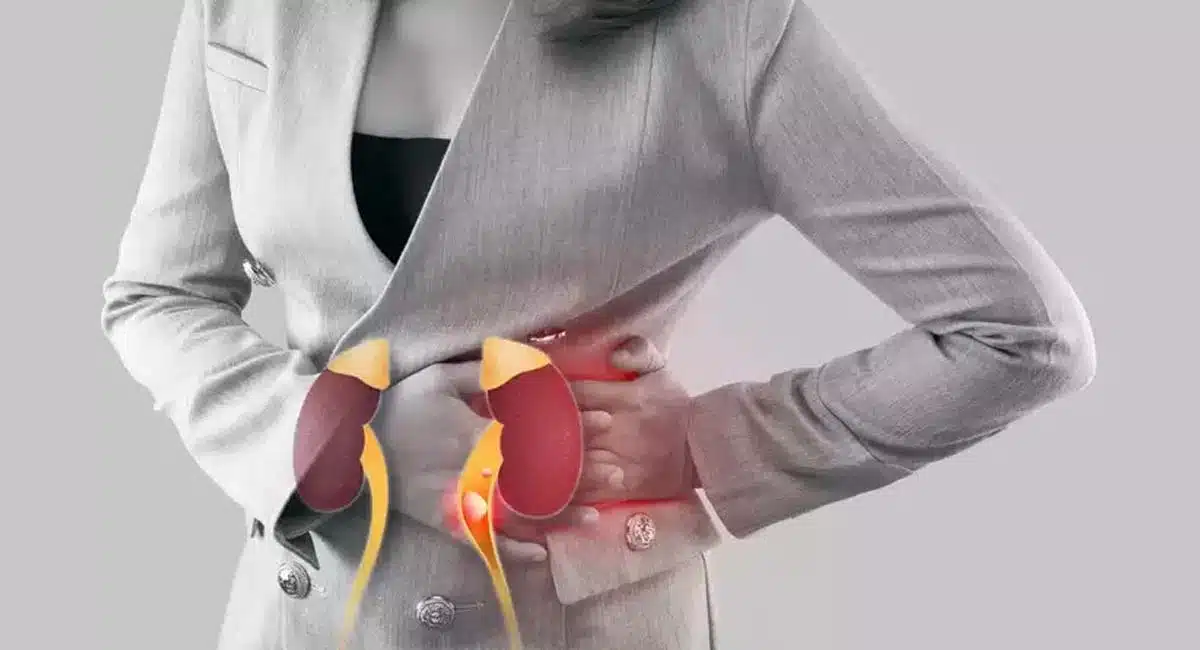 Eat these to get rid of kidney stones