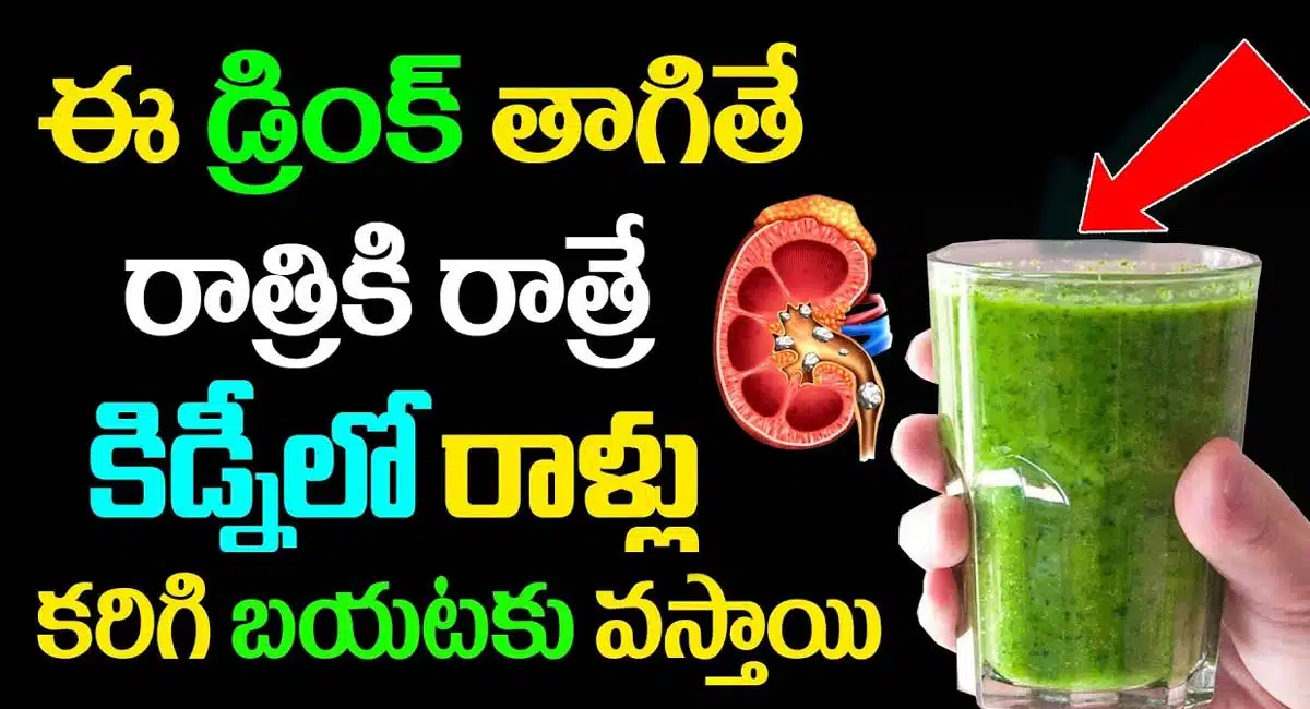 If you drink this drink, kidney stones will dissolve overnight