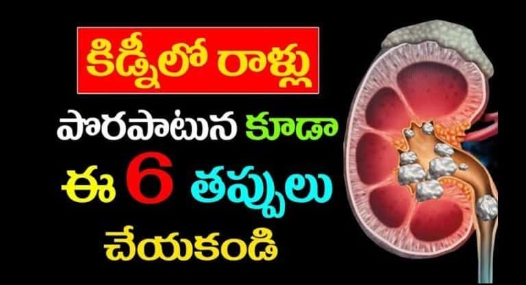 Kidney Stones : కిడ్నీలో రాళ్లు ఉన్నవారు పొరపాటున కూడా ఈ ఆరు తప్పులు చేయకండి…!