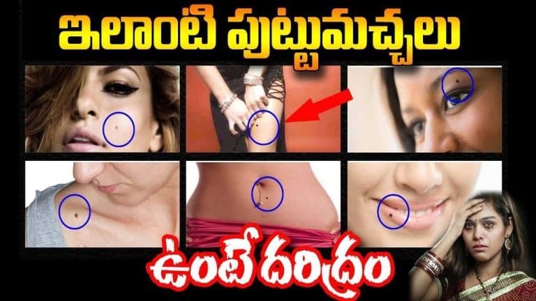 Astrology : శరీరంపై ఎలాంటి పుట్టుమచ్చలు ఉంటే దరిద్రం…!!