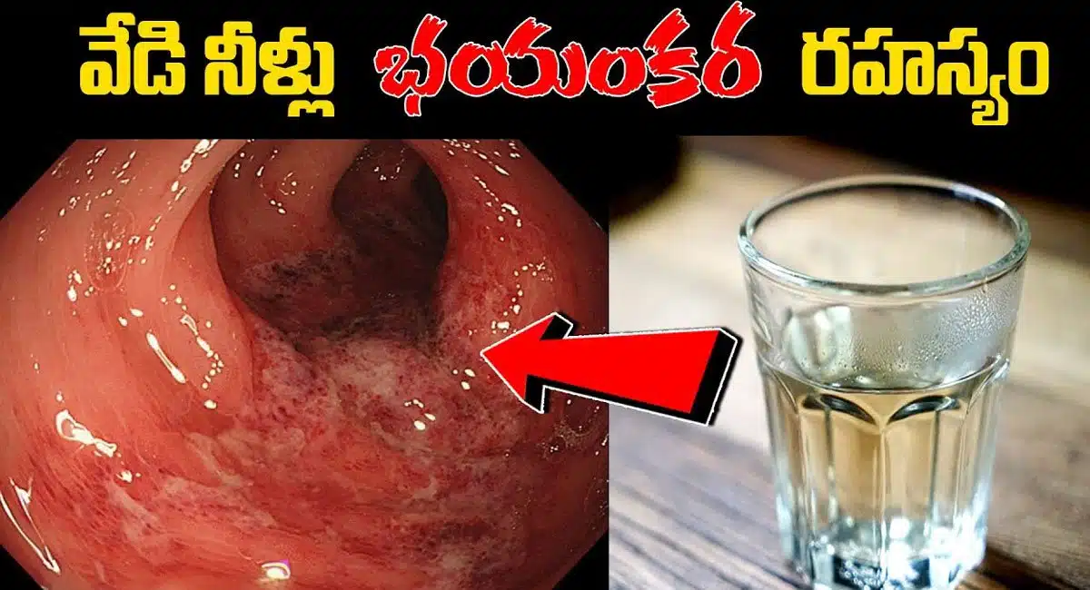 Drinking hot water in Early Morning