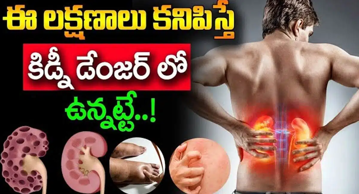 If these symptoms appear, then the kidney is in danger