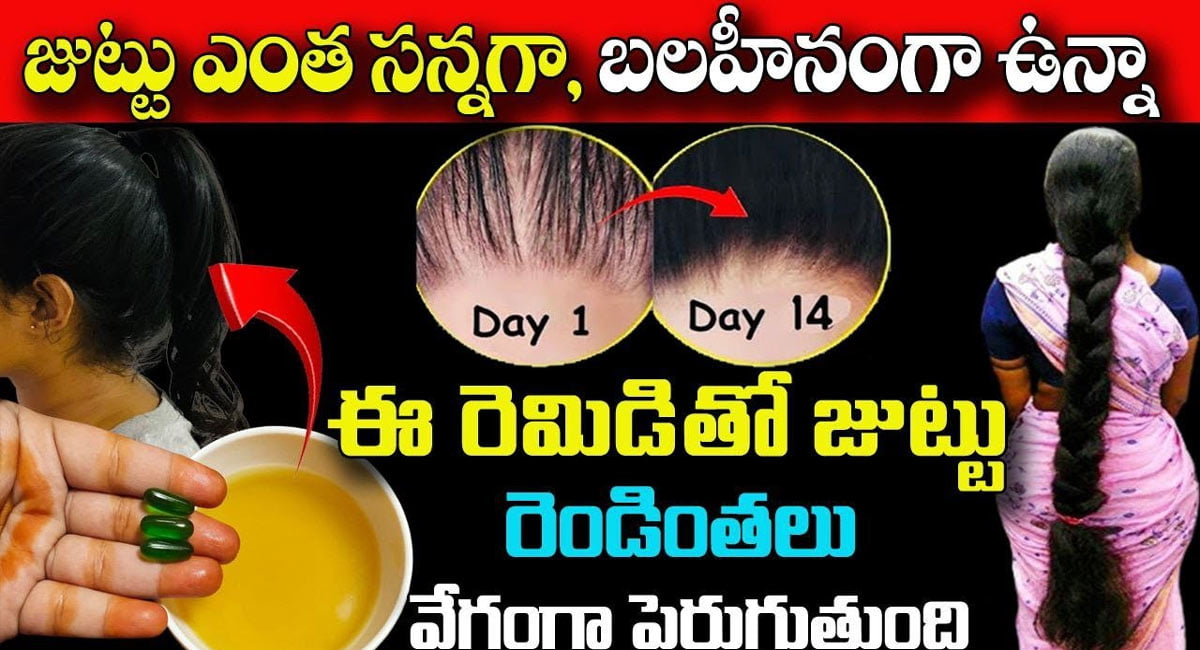 Hair Tips : జుట్టు ఎంత సన్నగా, బలహీనంగా ఉన్న ఈ రెమెడీతో జుట్టు రెండింతలు వేగంగా పెరుగుతుంది…!