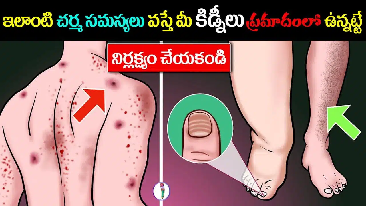 If you get these skin problems, your kidneys are at risk