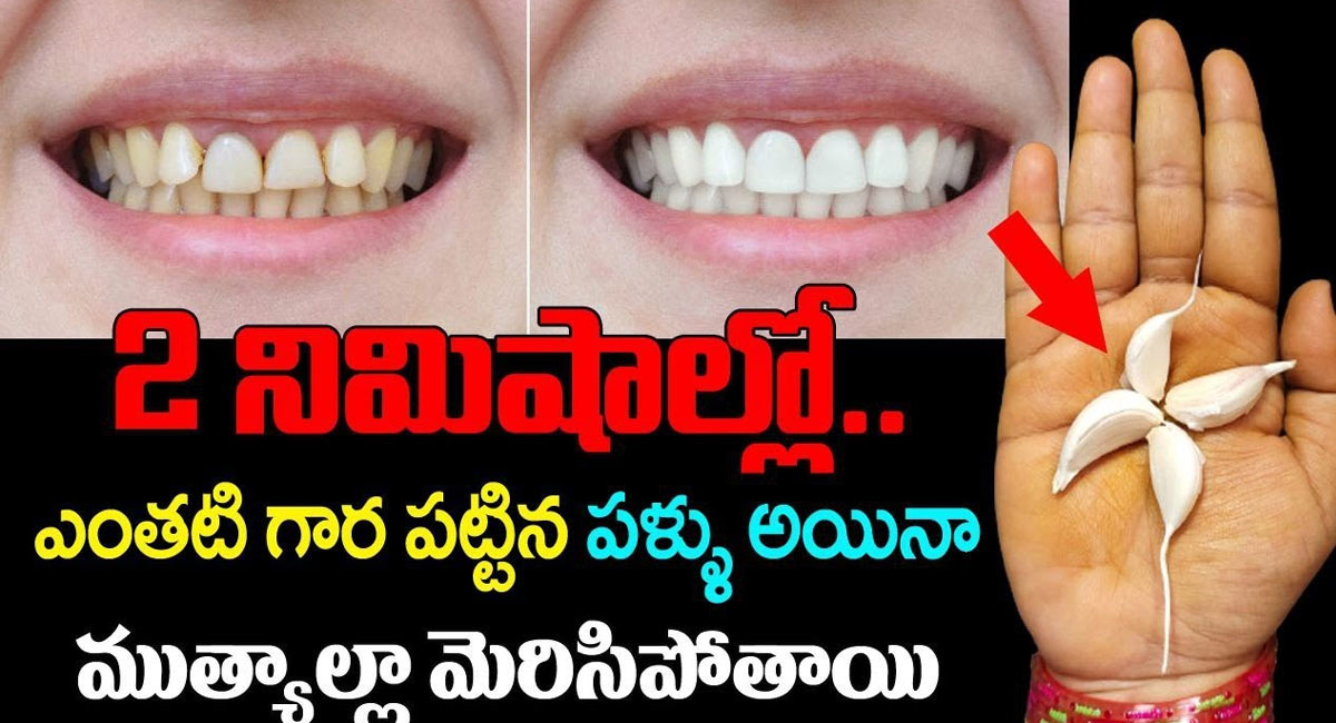 Health Benefits : 2 నిమిషాల్లో ఎంతటి గార పట్టిన పళ్ళు అయిన ముత్యాల మెరిసిపోతాయి..!