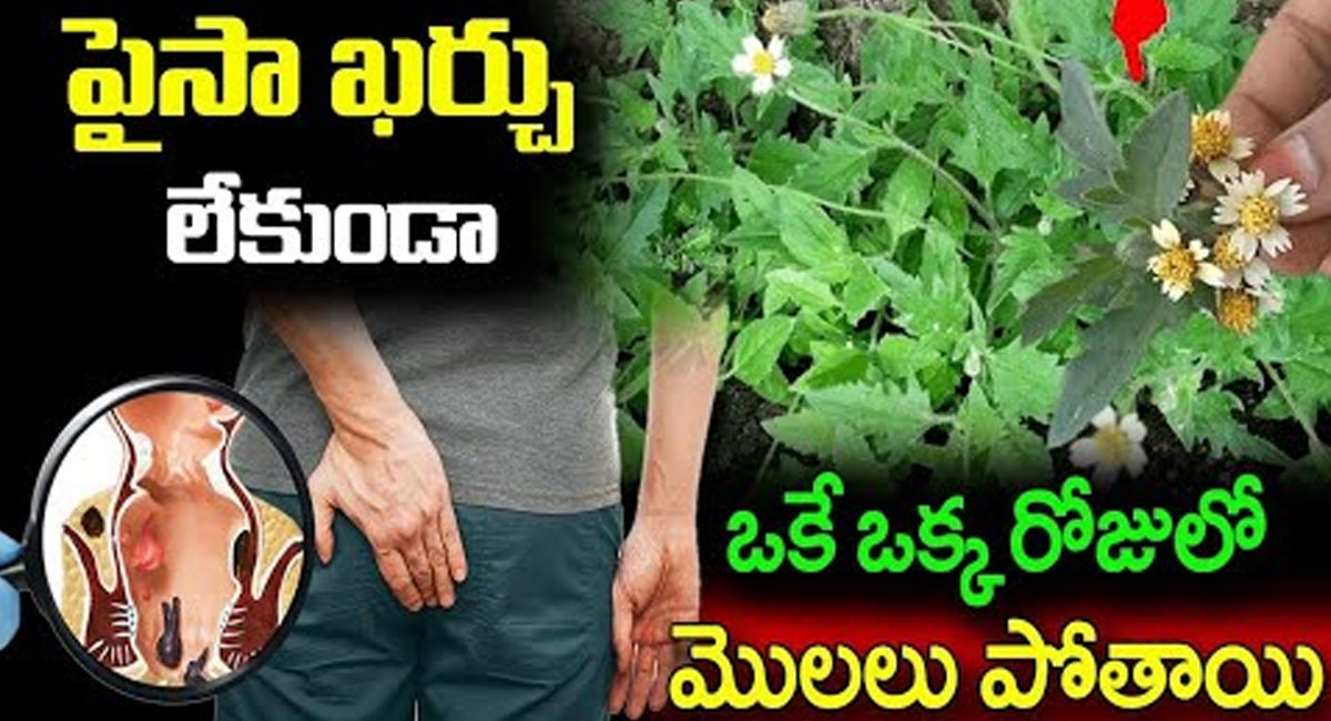 Piles disappear: పైసా ఖర్చు లేకుండా ఒకే ఒక్క రోజులో మొలలు మాయం..