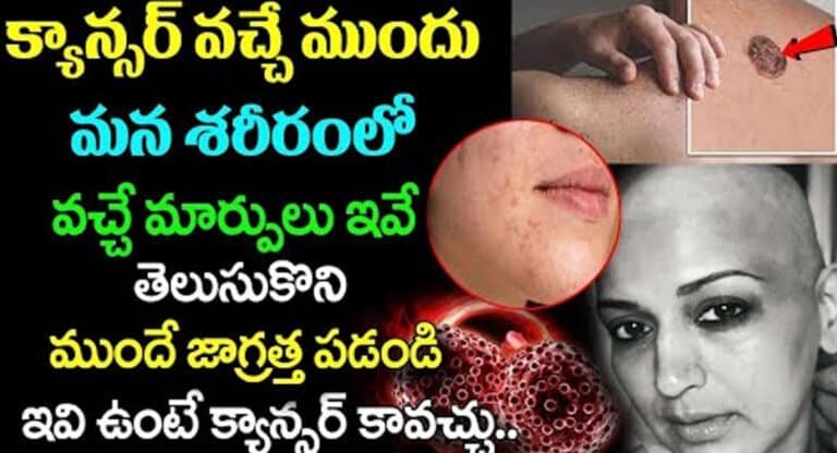 Cancer : క్యాన్సర్ వచ్చే ముందు మన శరీరంలో వచ్చే మార్పులు ఇవే…!