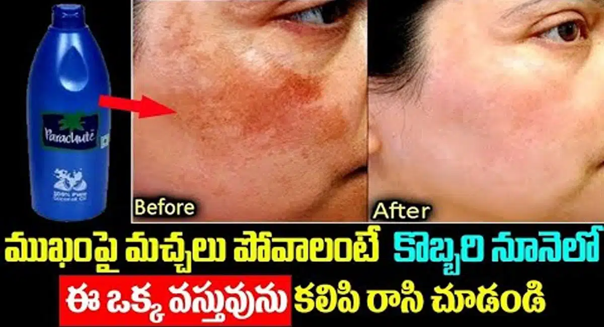 If you want to get rid of blemishes on your face