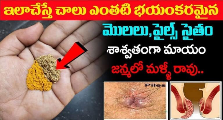 ఇలా చేస్తే చాలు.. ఎంతటి భయంకరమైన మొలలు ఫైల్స్ సైతం శాశ్వతంగా మాయం…!