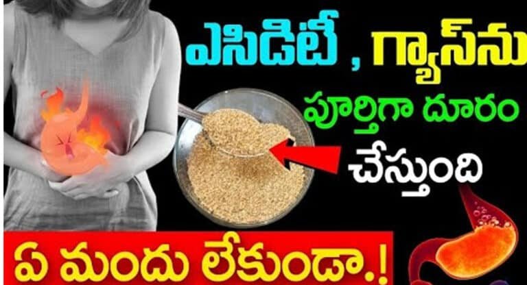 Acidity Gas : ఎసిడిటీ, గ్యాస్ ను ఏ మందు లేకుండా పూర్తిగా దూరం చేస్తుంది…!