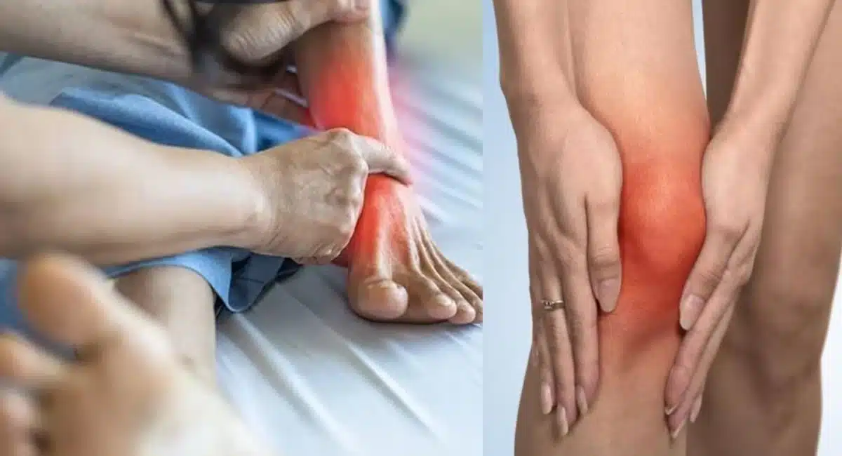 శరీరంలో యూరిక్ యాసిడ్ ను తగ్గించే ఆహారాలు ఇవే