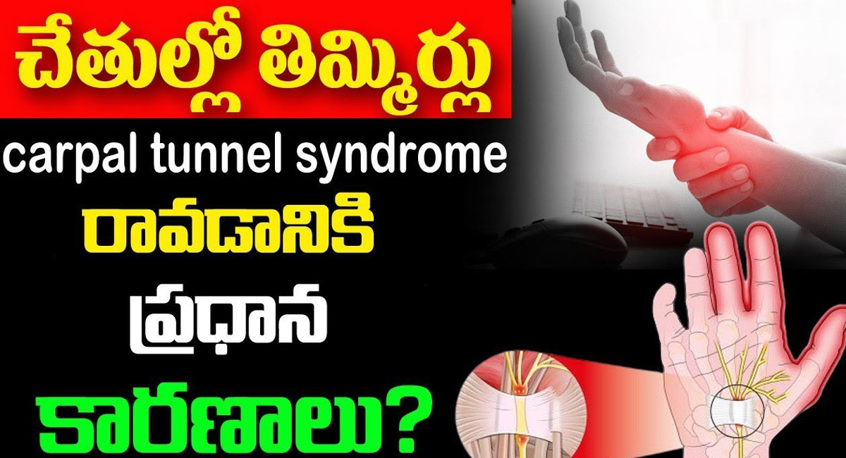 Carpal Tunnel : చేతుల్లో తిమ్మిర్లు రావడానికి పదా ప్రధాన కారణాలు…!