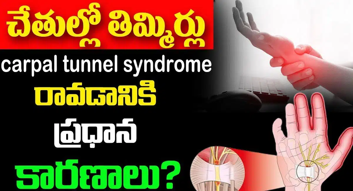 Carpal Tunnel : చేతుల్లో తిమ్మిర్లు రావడానికి పదా ప్రధాన కారణాలు...!