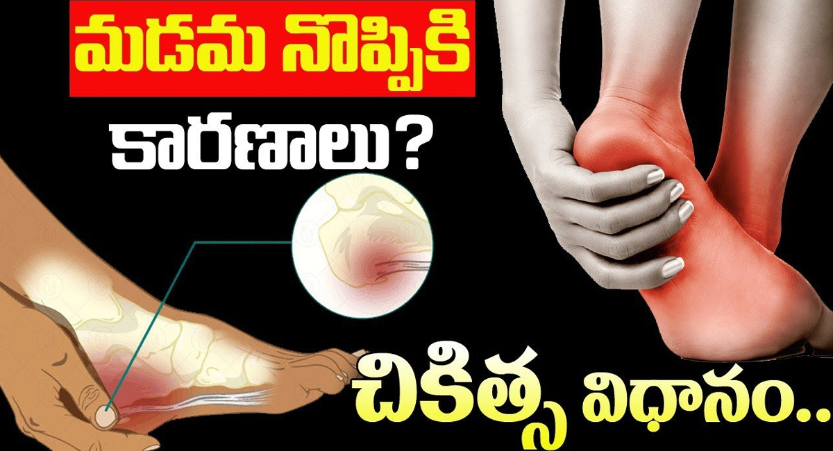 Heel Pain : మడమ నొప్పికి కారణాలేంటి ..??ఇంట్లోనే చికిత్స ఎలా చేయాలి ..??